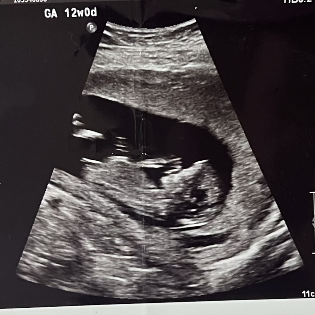 Photo shared by Dakota for their Babylist baby registry.