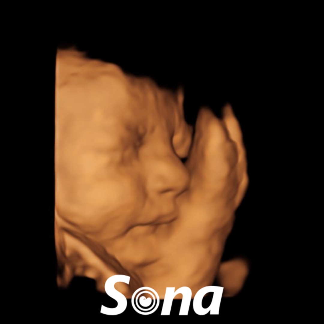 Photo shared by Ave for their Babylist baby registry.