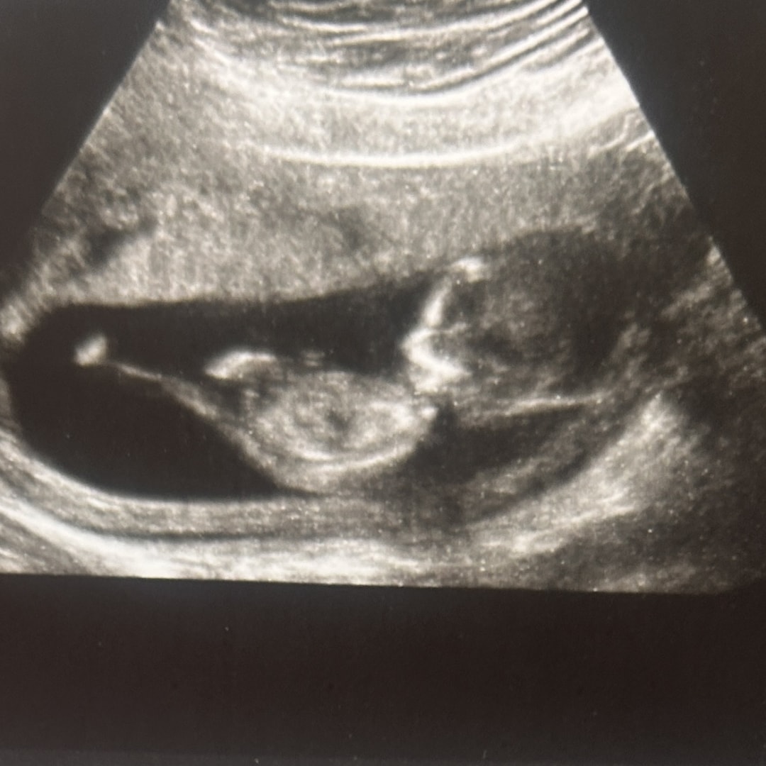 Photo shared by Kaci for their Babylist baby registry.