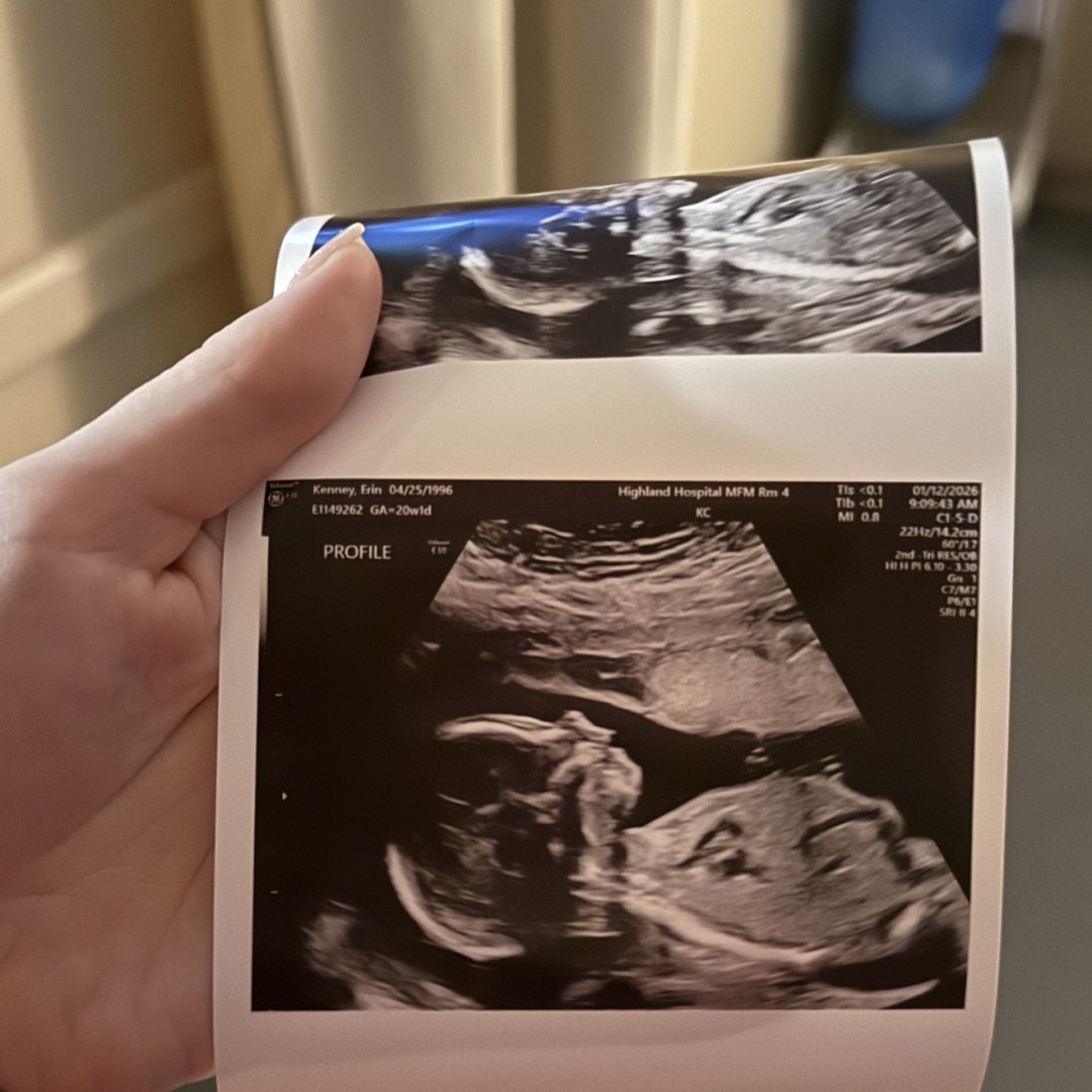 Photo shared by Erin for their Babylist baby registry.