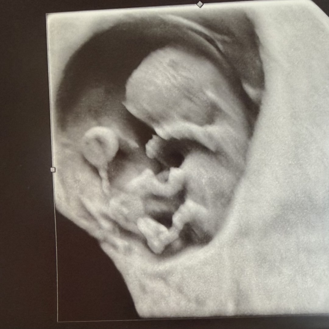 Photo shared by Brittany for their Babylist baby registry.