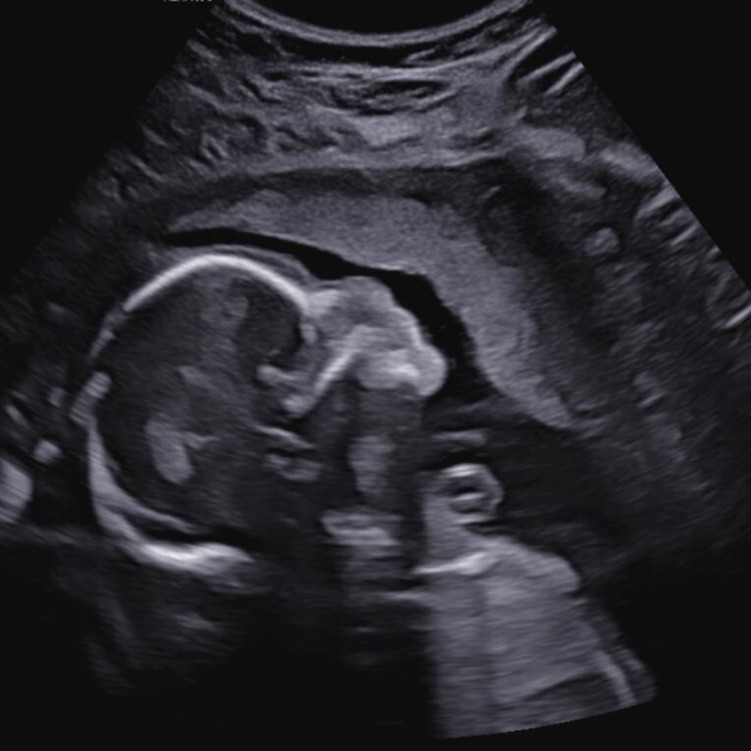 Photo shared by Alyssa for their Babylist baby registry.