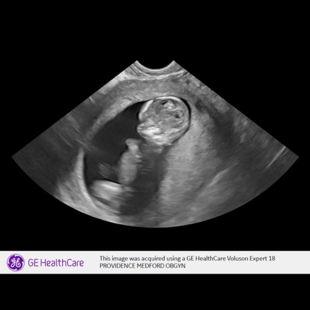 Photo shared by Joely for their Babylist baby registry.