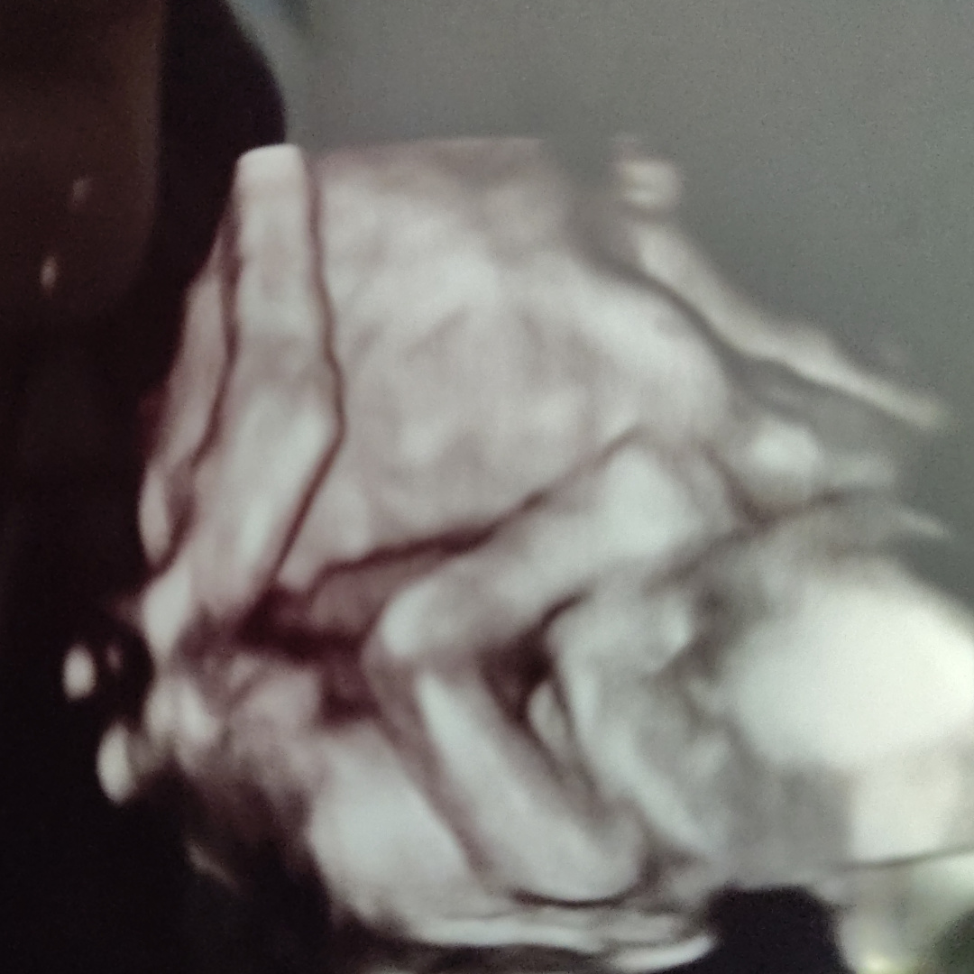 Photo shared by Haley for their Babylist baby registry.