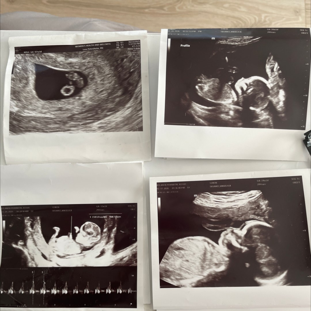 Photo shared by Angelica for their Babylist baby registry.