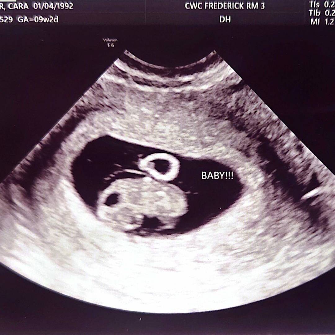 Photo shared by Cara for their Babylist baby registry.