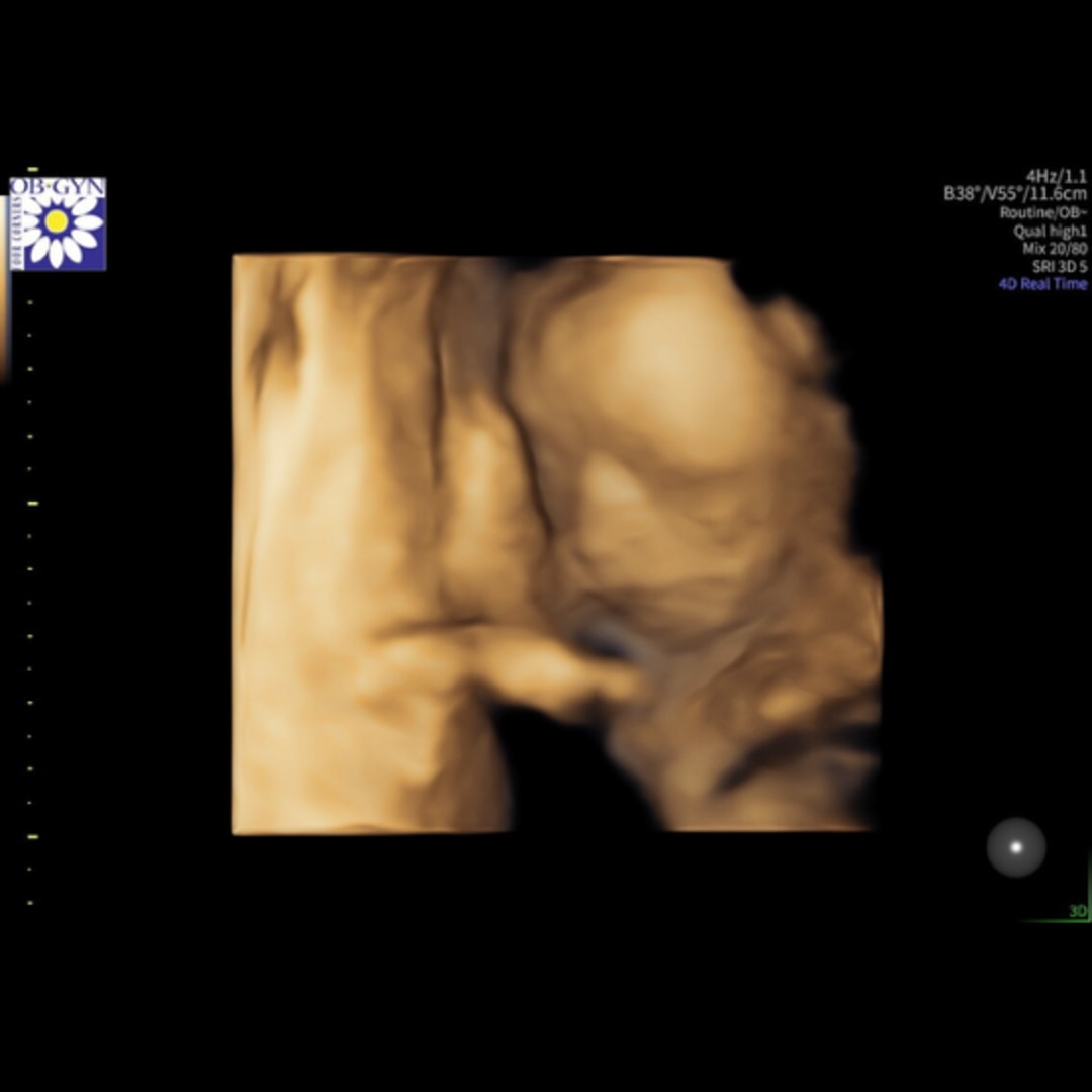 Photo shared by Annalyse for their Babylist baby registry.