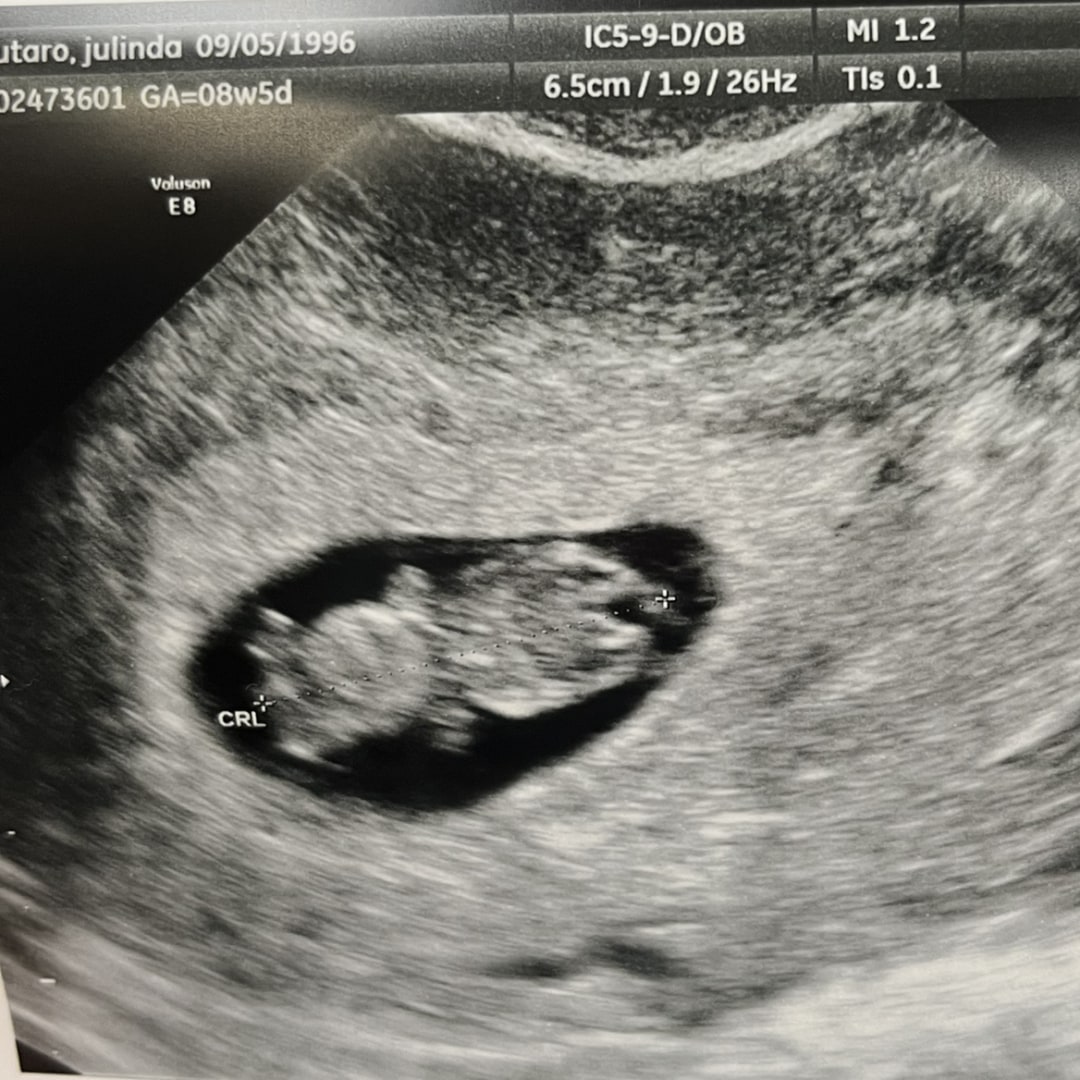 Photo shared by Julinda for their Babylist baby registry.