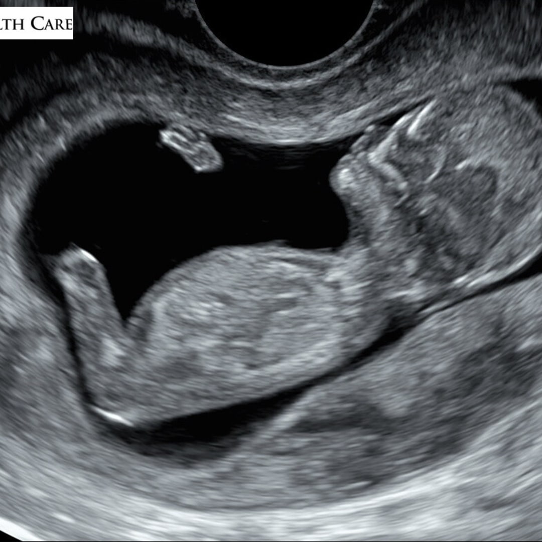 Photo shared by Alysha for their Babylist baby registry.