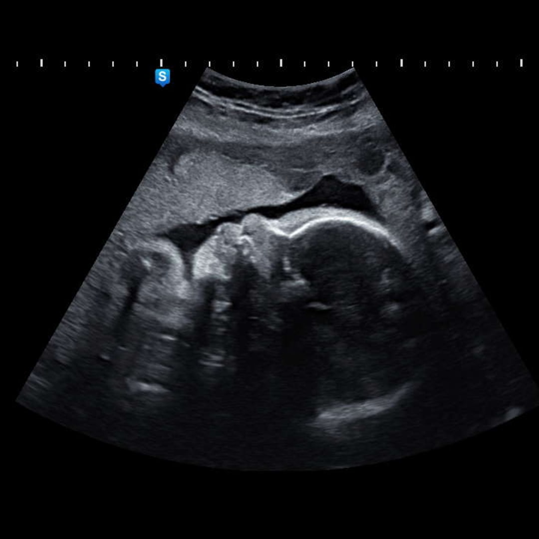 Photo shared by Azesha for their Babylist baby registry.