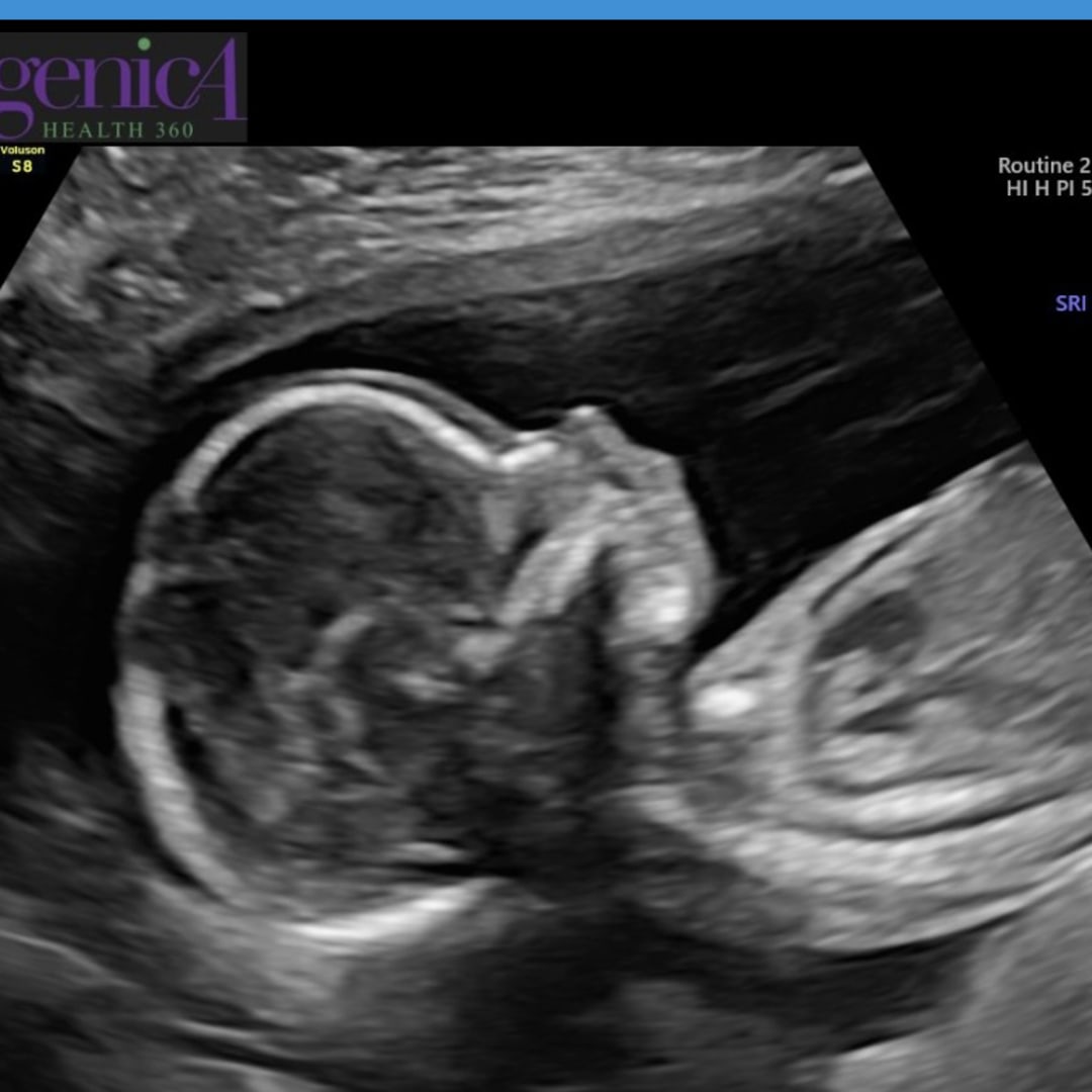 Photo shared by Madison for their Babylist baby registry.