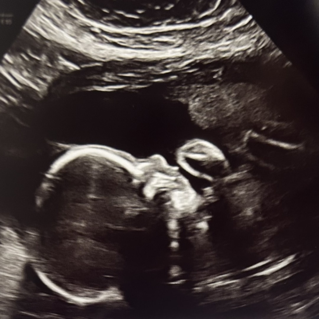 Photo shared by Ashley for their Babylist baby registry.