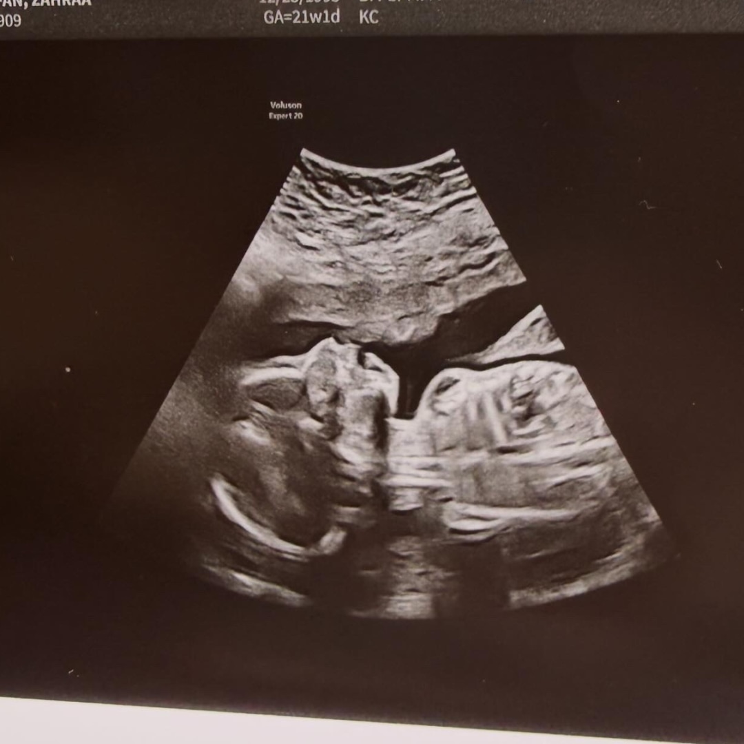 Photo shared by Danette for their Babylist baby registry.
