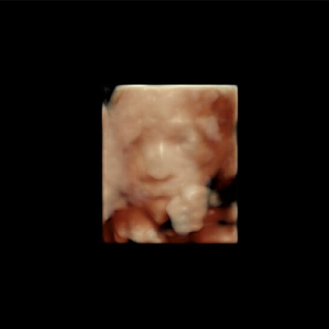 Photo shared by Marlene for their Babylist baby registry.