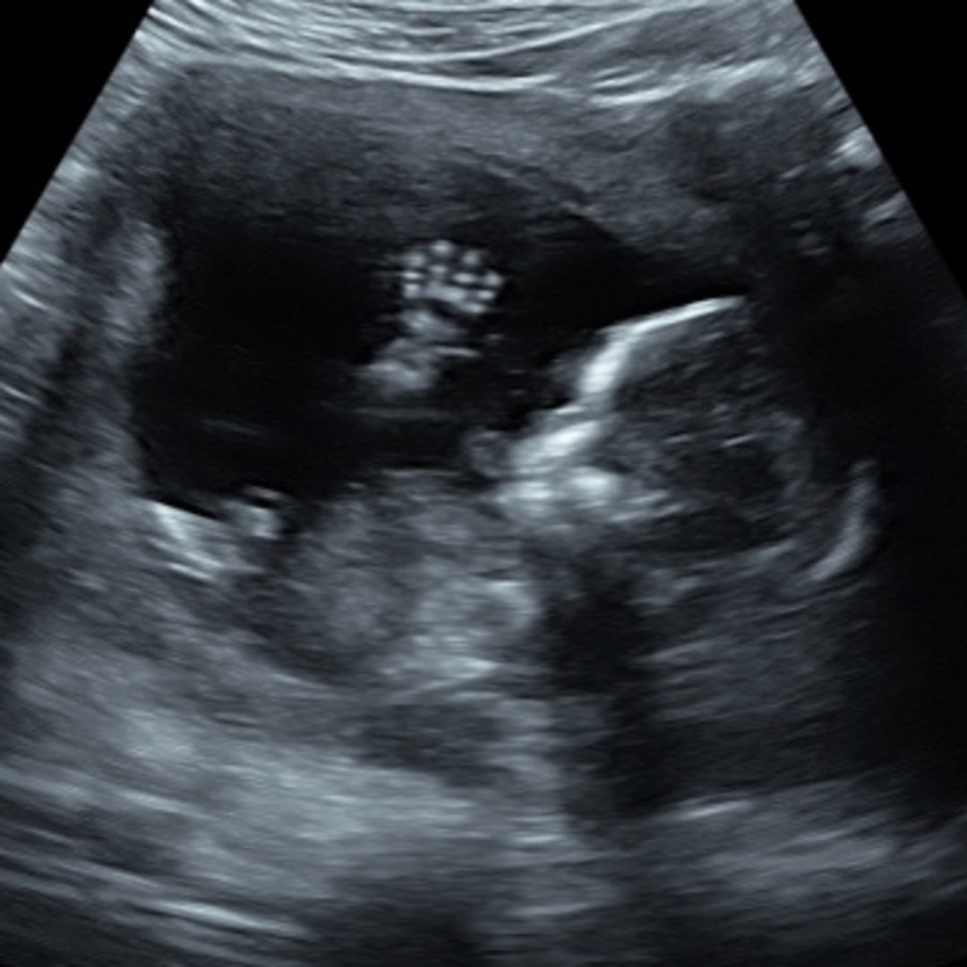Photo shared by Alejandra for their Babylist baby registry.