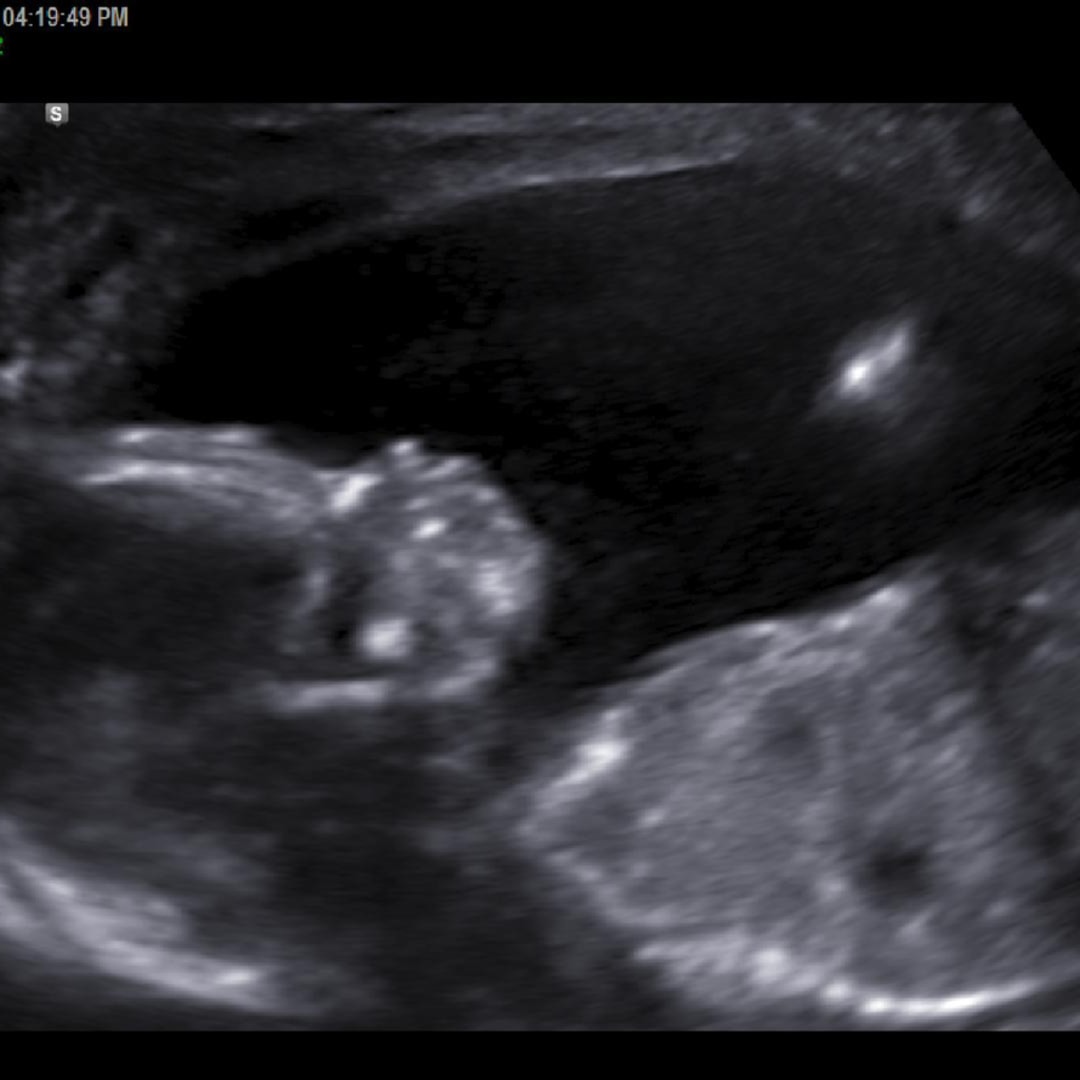 Photo shared by Haley for their Babylist baby registry.