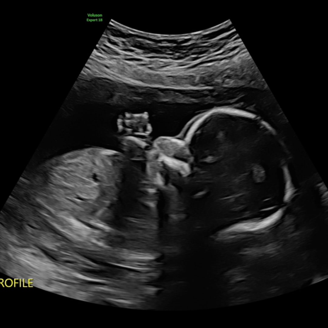 Photo shared by Emma for their Babylist baby registry.