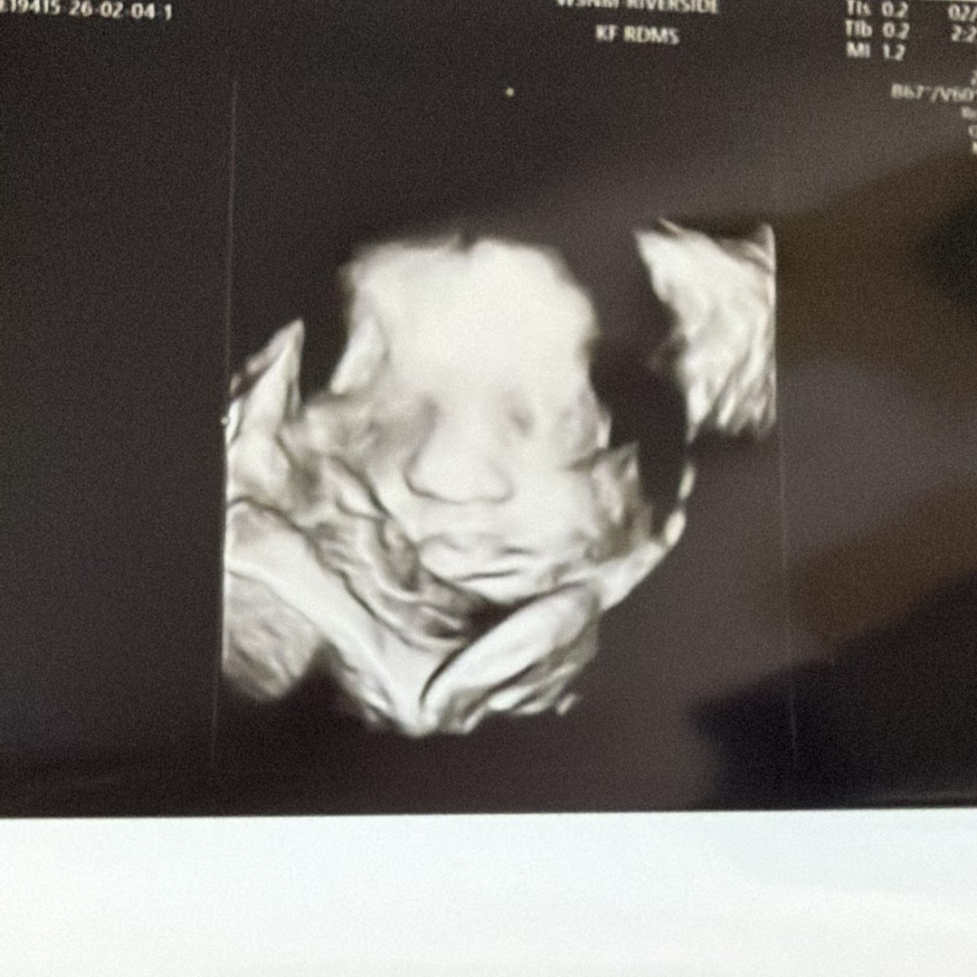 Photo shared by Kaitlin for their Babylist baby registry.