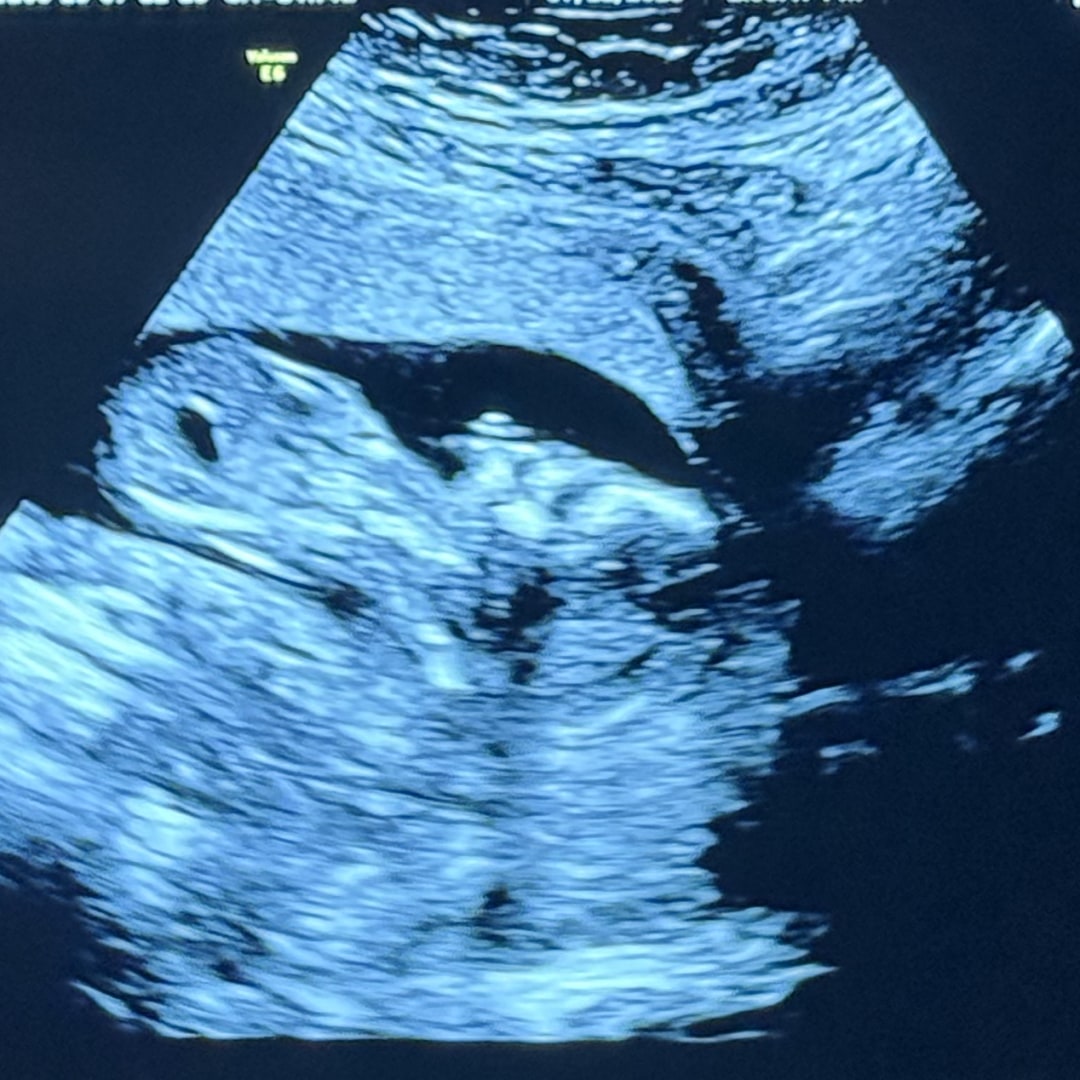 Photo shared by Kenna for their Babylist baby registry.