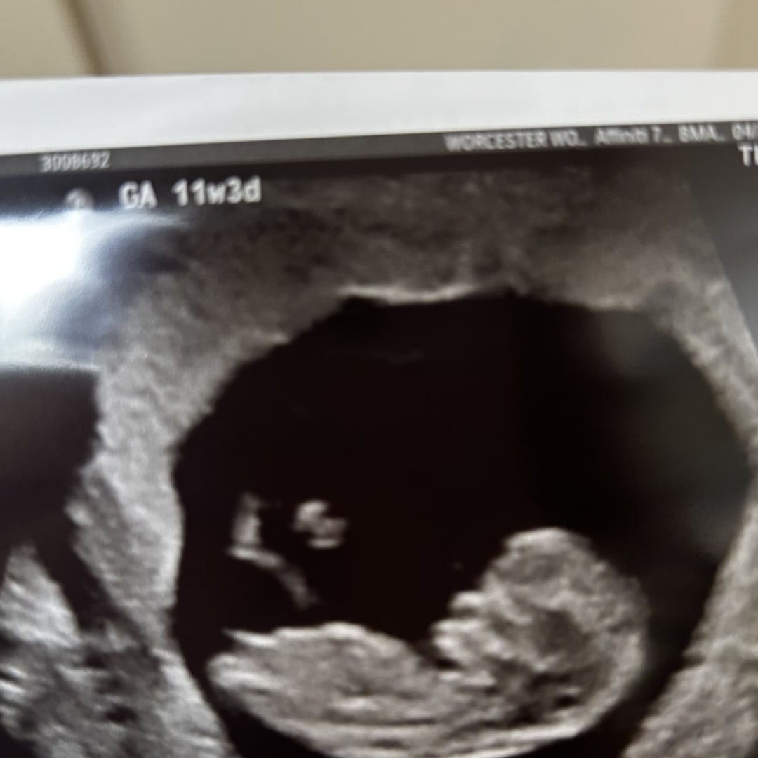 Photo shared by Carley for their Babylist baby registry.