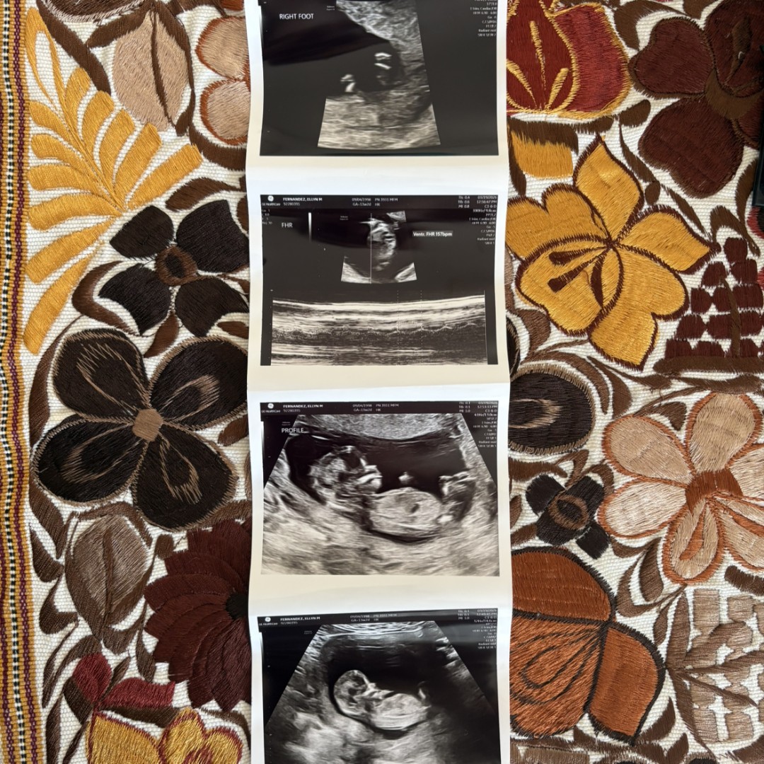 Photo shared by Elly for their Babylist baby registry.