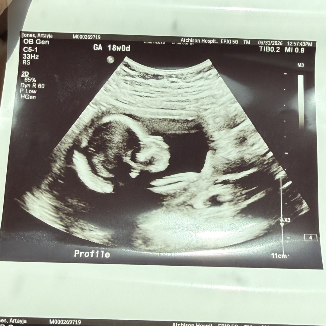 Photo shared by Tayja & Steven for their Babylist baby registry.