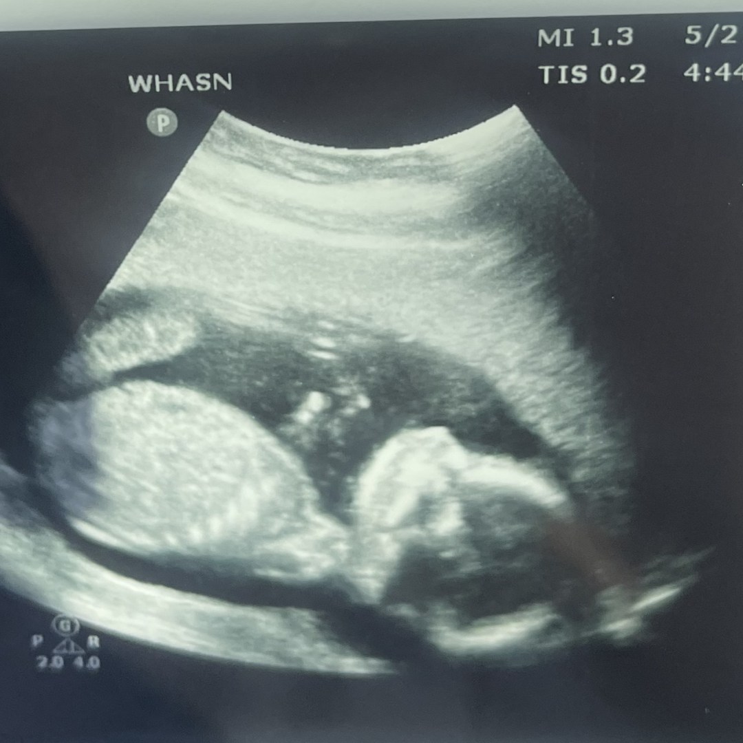 Photo shared by Miranda for their Babylist baby registry.