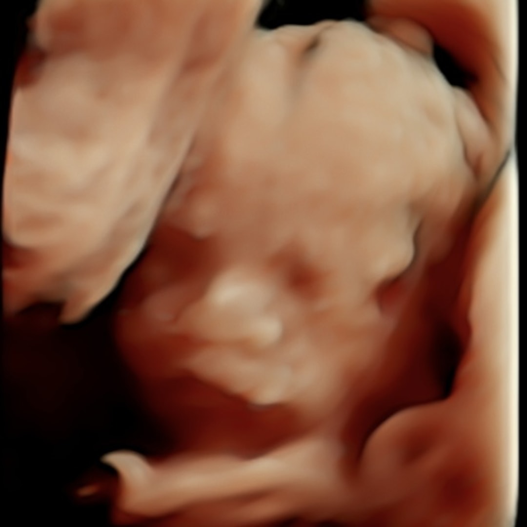 Photo shared by Misty for their Babylist baby registry.