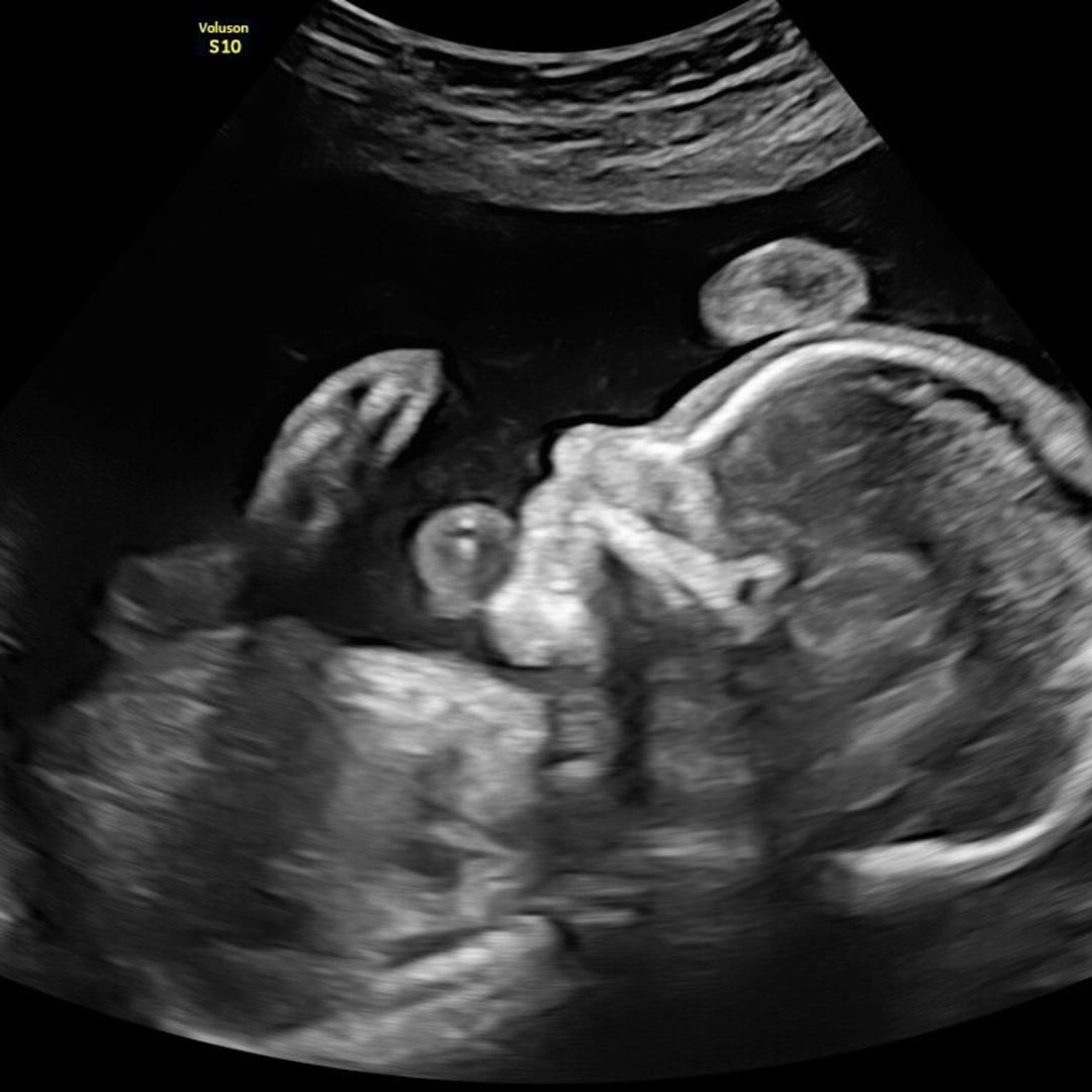 Photo shared by Presli for their Babylist baby registry.