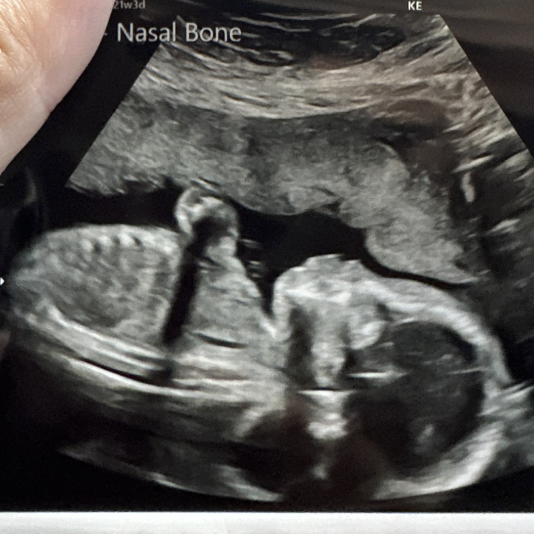 Photo shared by Melanie for their Babylist baby registry.