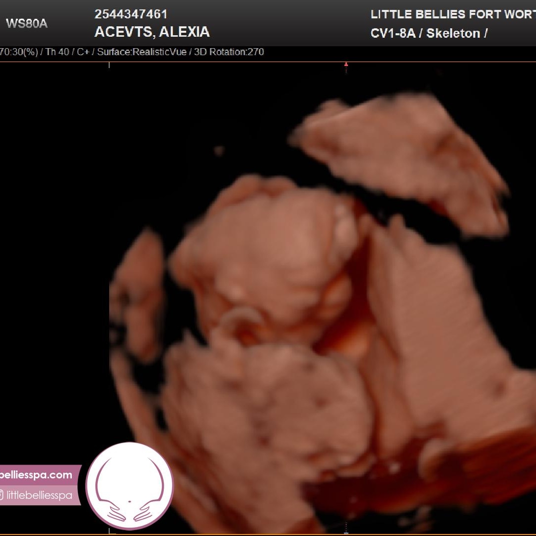 Photo shared by Alexia for their Babylist baby registry.