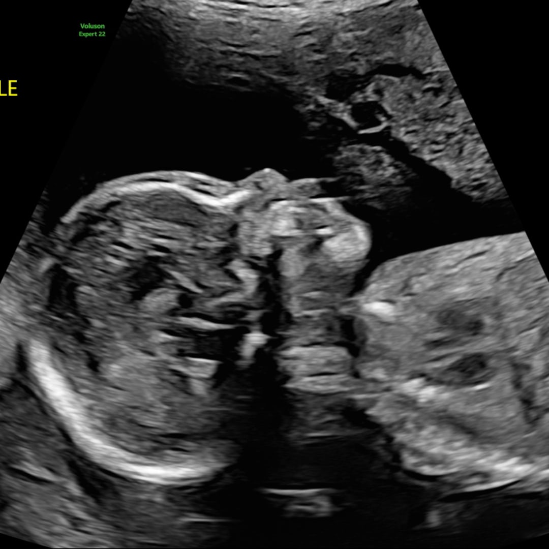 Photo shared by Gao-Lou for their Babylist baby registry.
