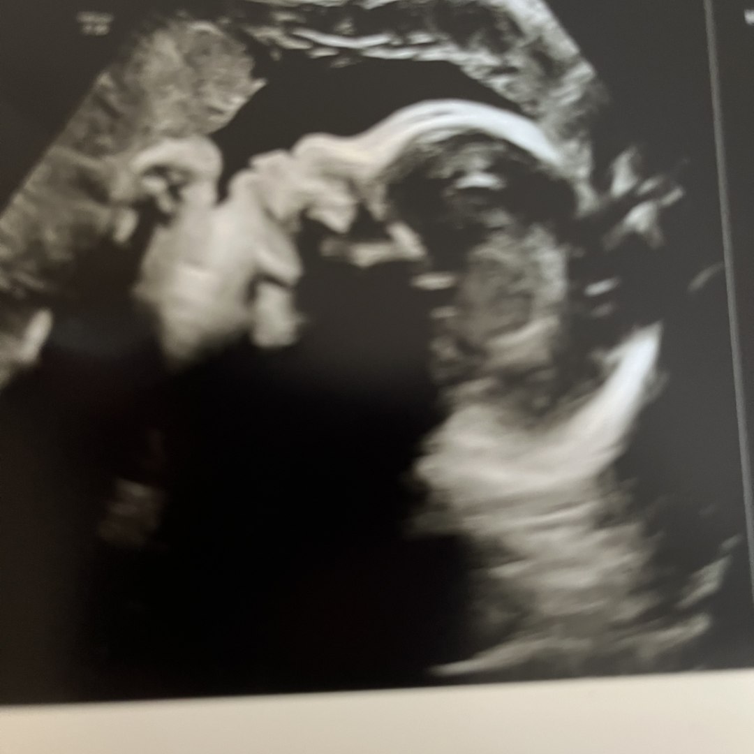 Photo shared by Kiah for their Babylist baby registry.