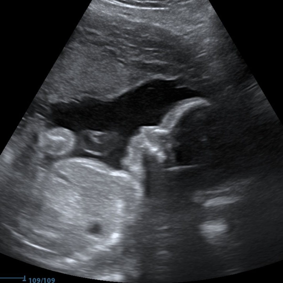 Photo shared by Jami for their Babylist baby registry.