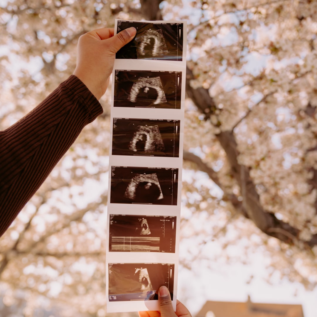 Photo shared by Bailey for their Babylist baby registry.