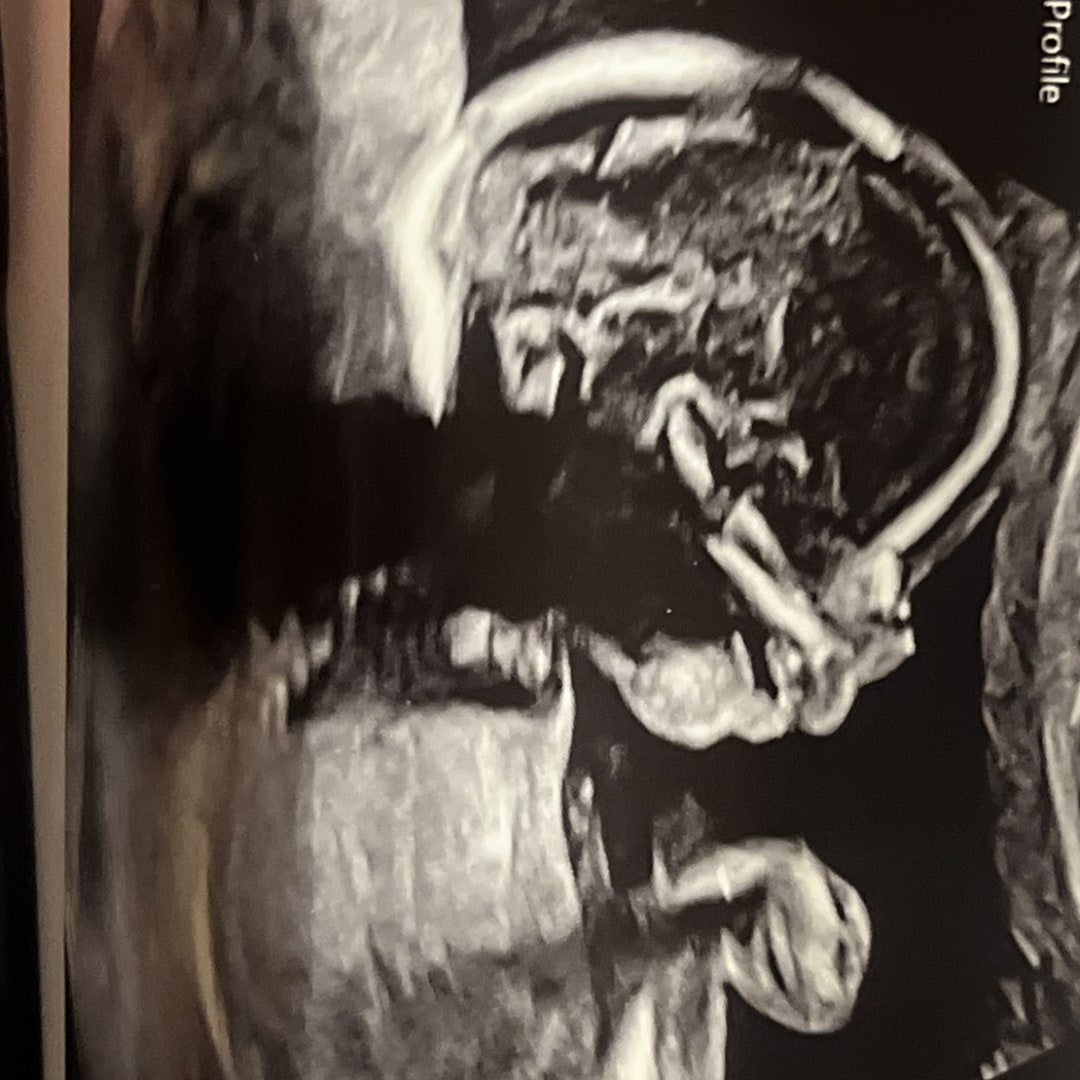 Photo shared by Haley for their Babylist baby registry.