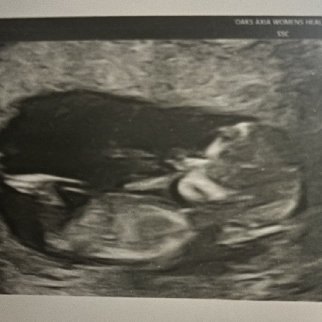 Photo shared by Christina for their Babylist baby registry.