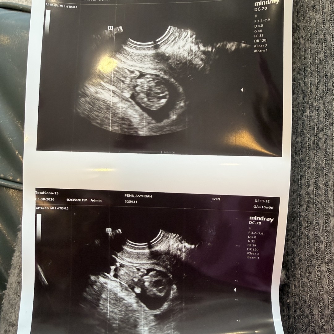 Photo shared by Asyiriah for their Babylist baby registry.
