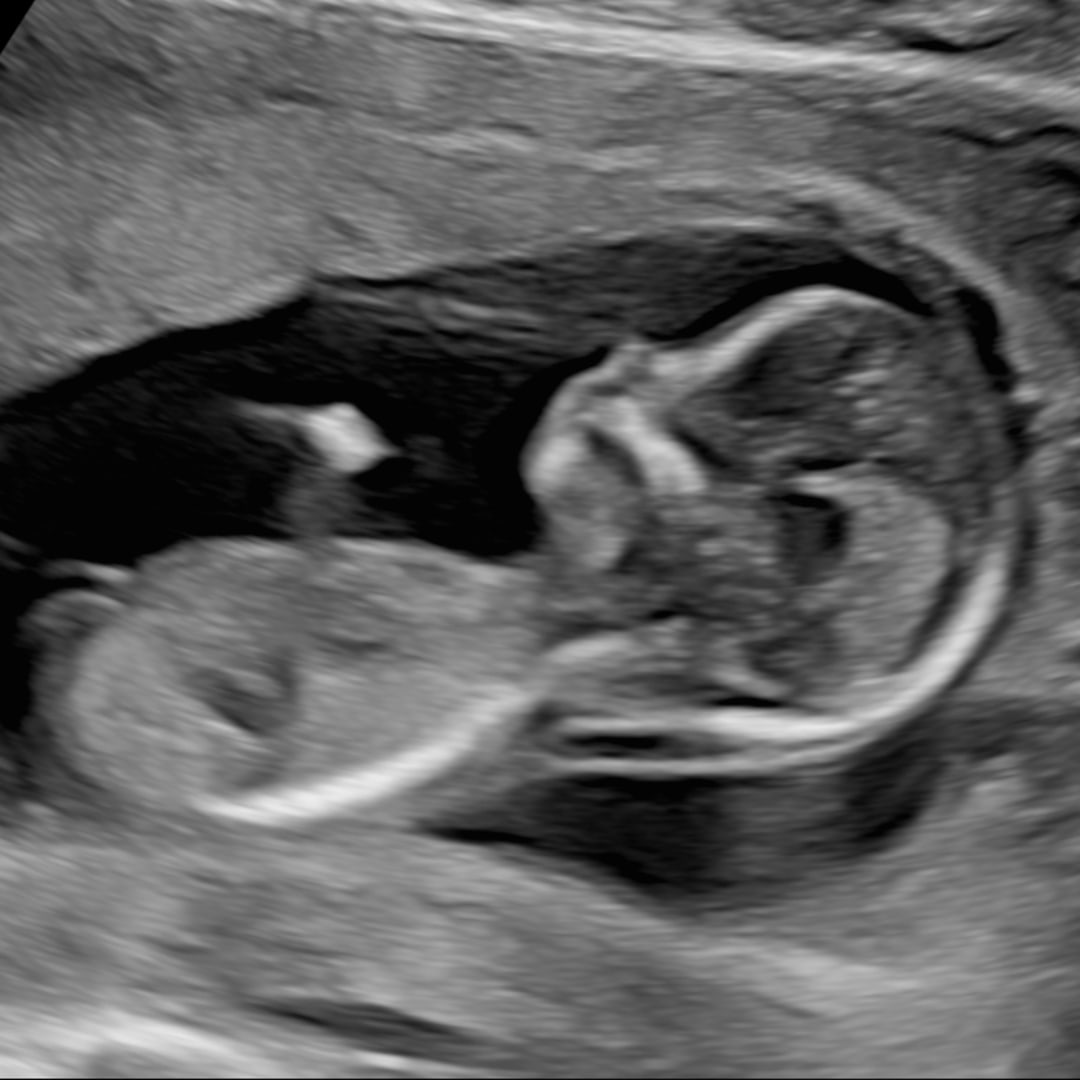 Photo shared by Elisaida for their Babylist baby registry.