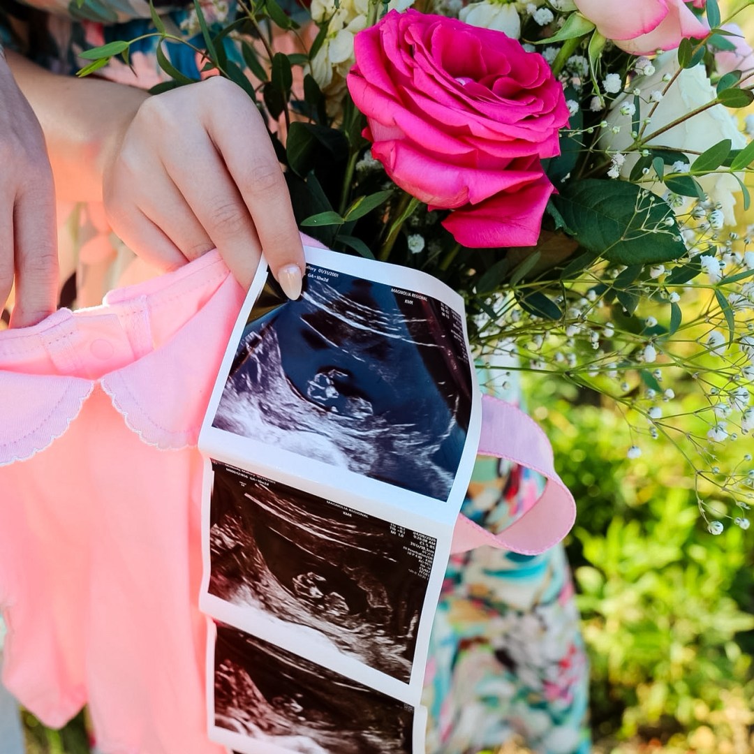 Photo shared by Mallory for their Babylist baby registry.