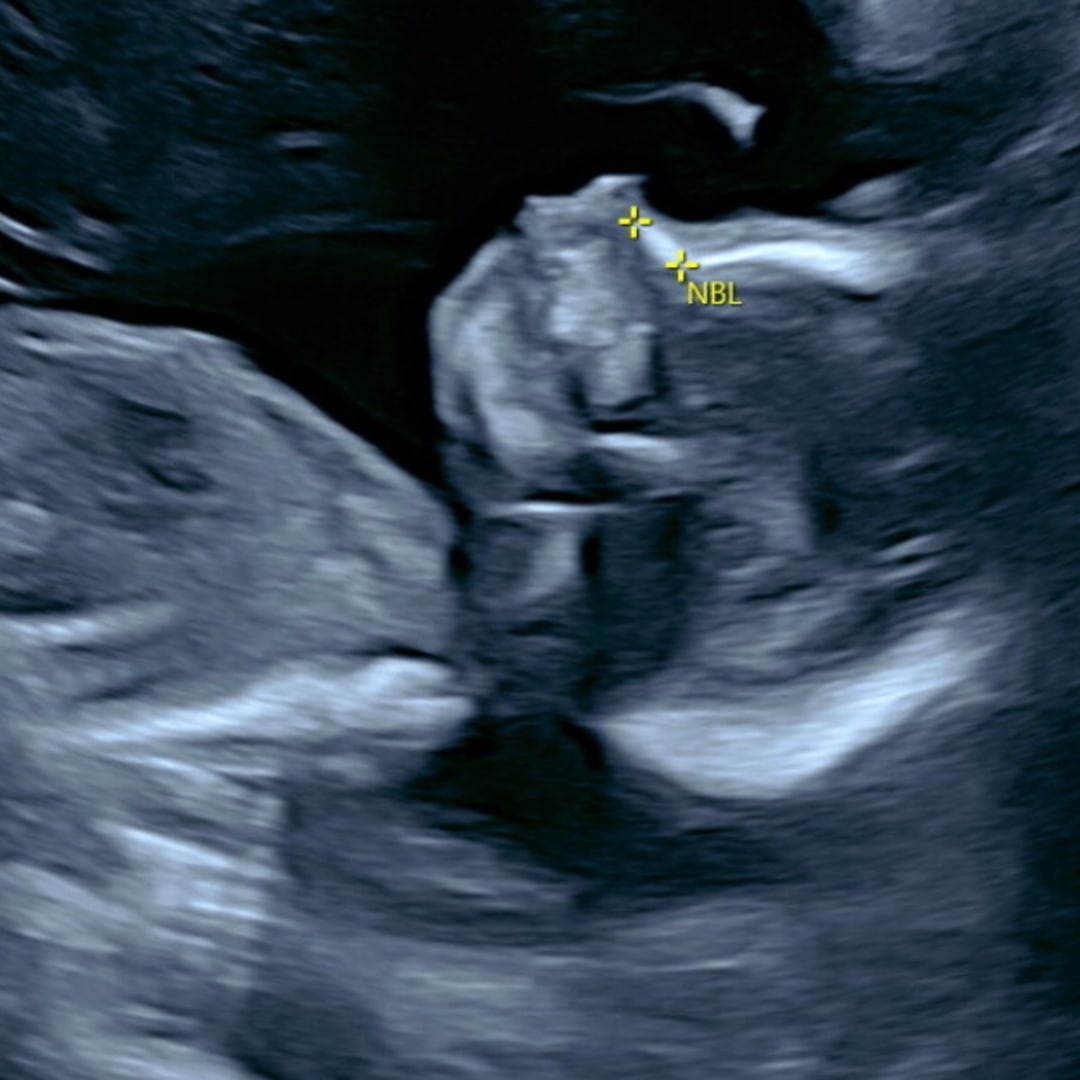 Photo shared by Kiyawana for their Babylist baby registry.