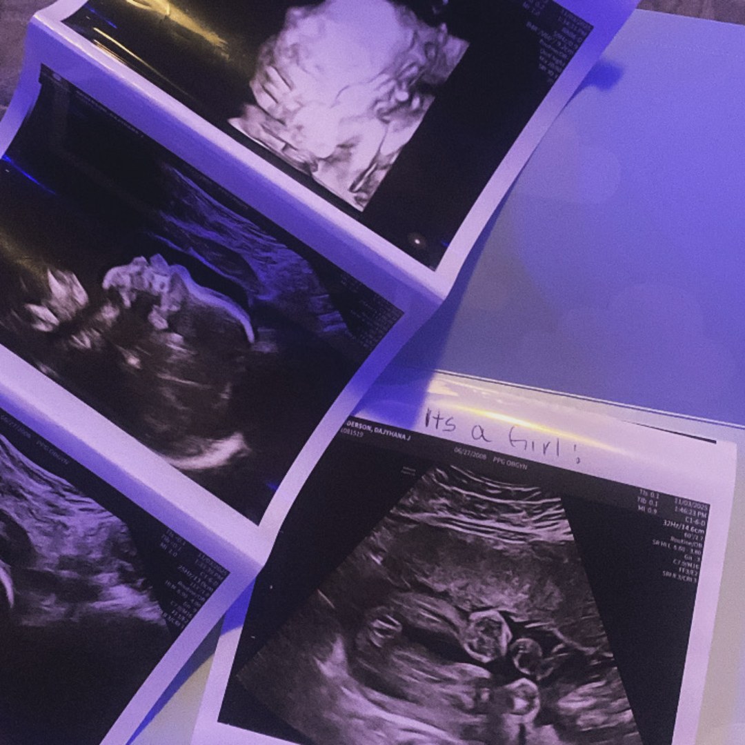 Photo shared by Dajyahna for their Babylist baby registry.