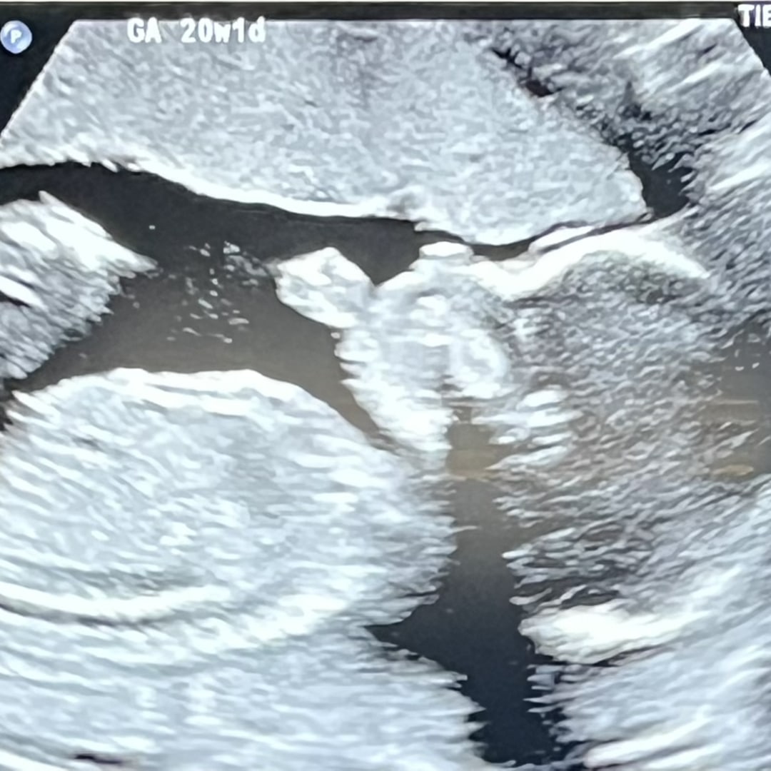 Photo shared by Pauline for their Babylist baby registry.