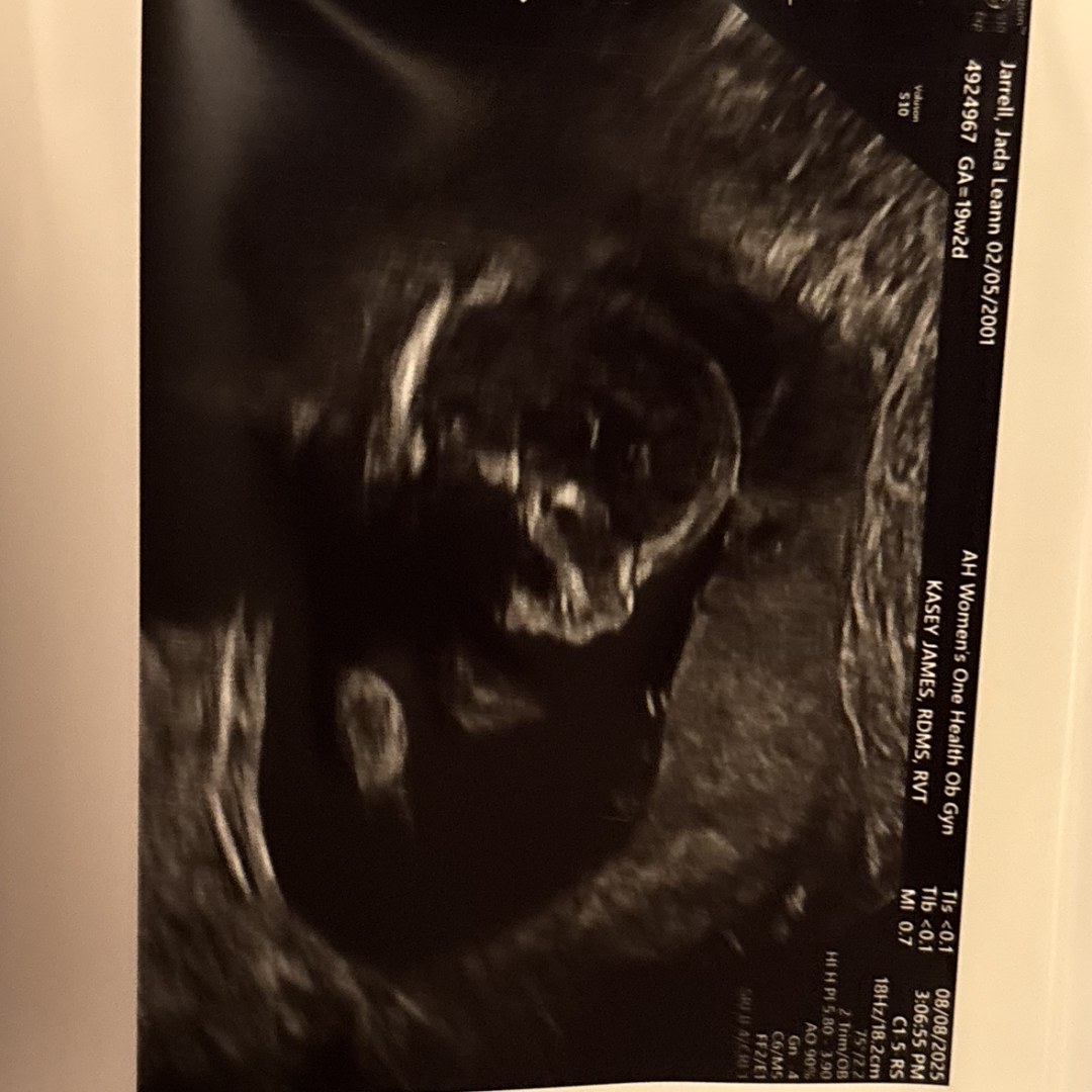 Photo shared by Jada for their Babylist baby registry.