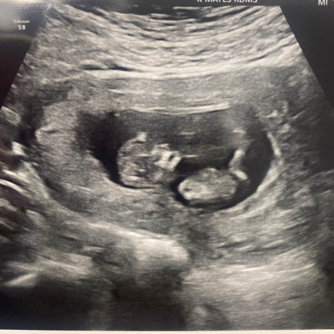 Photo shared by Emily for their Babylist baby registry.