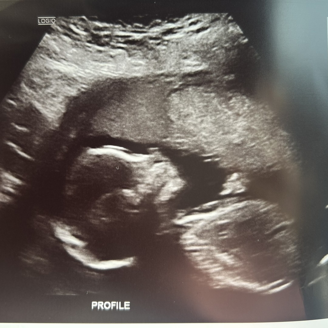 Photo shared by Makena for their Babylist baby registry.