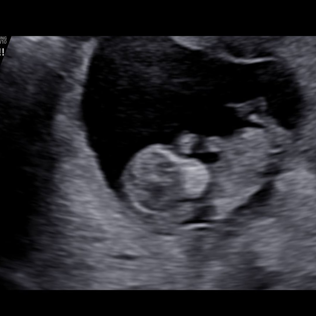 Photo shared by Mikina for their Babylist baby registry.