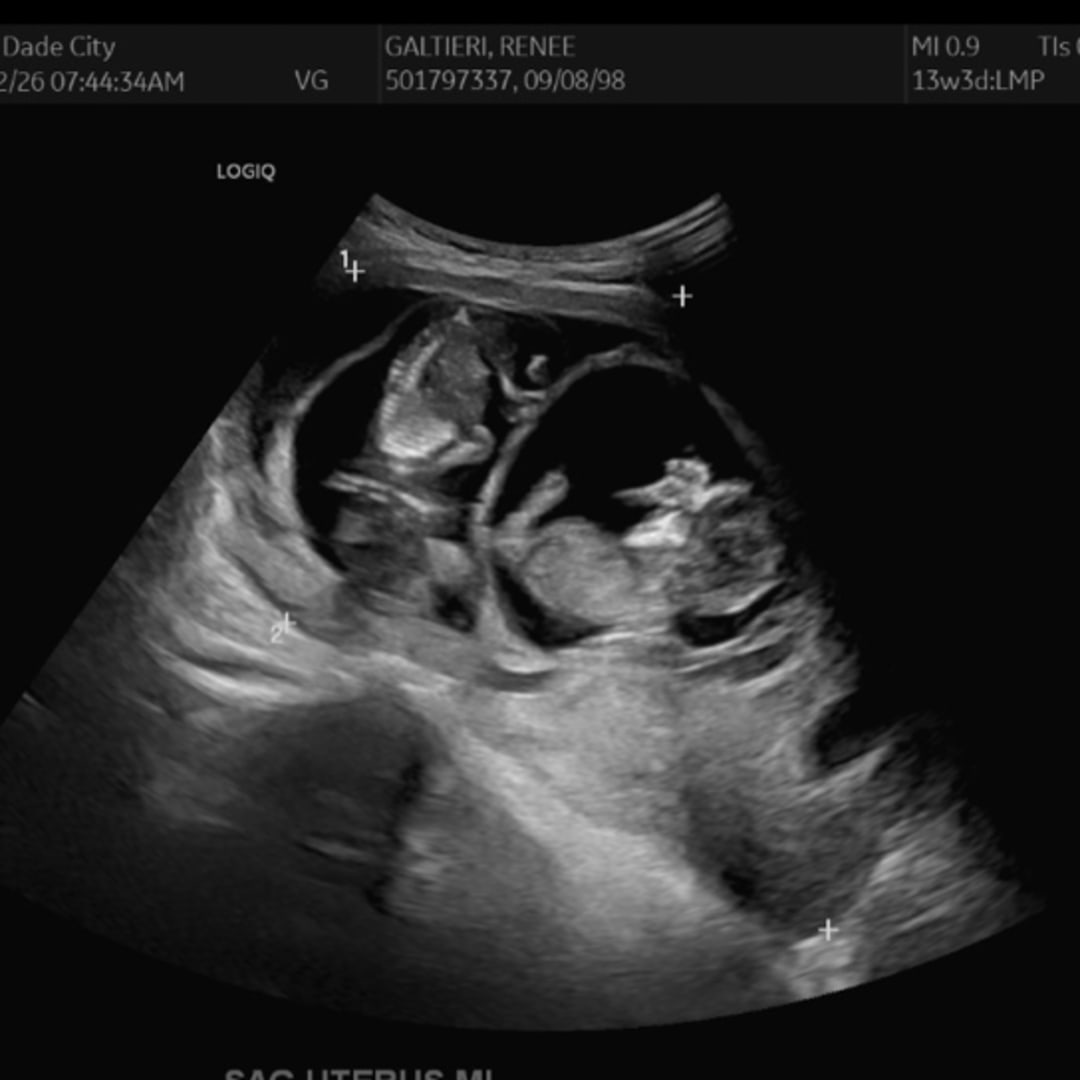 Photo shared by Renee for their Babylist baby registry.