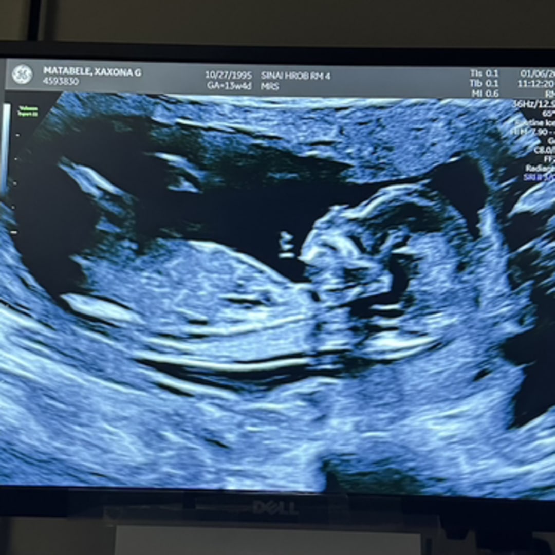Photo shared by Xay for their Babylist baby registry.