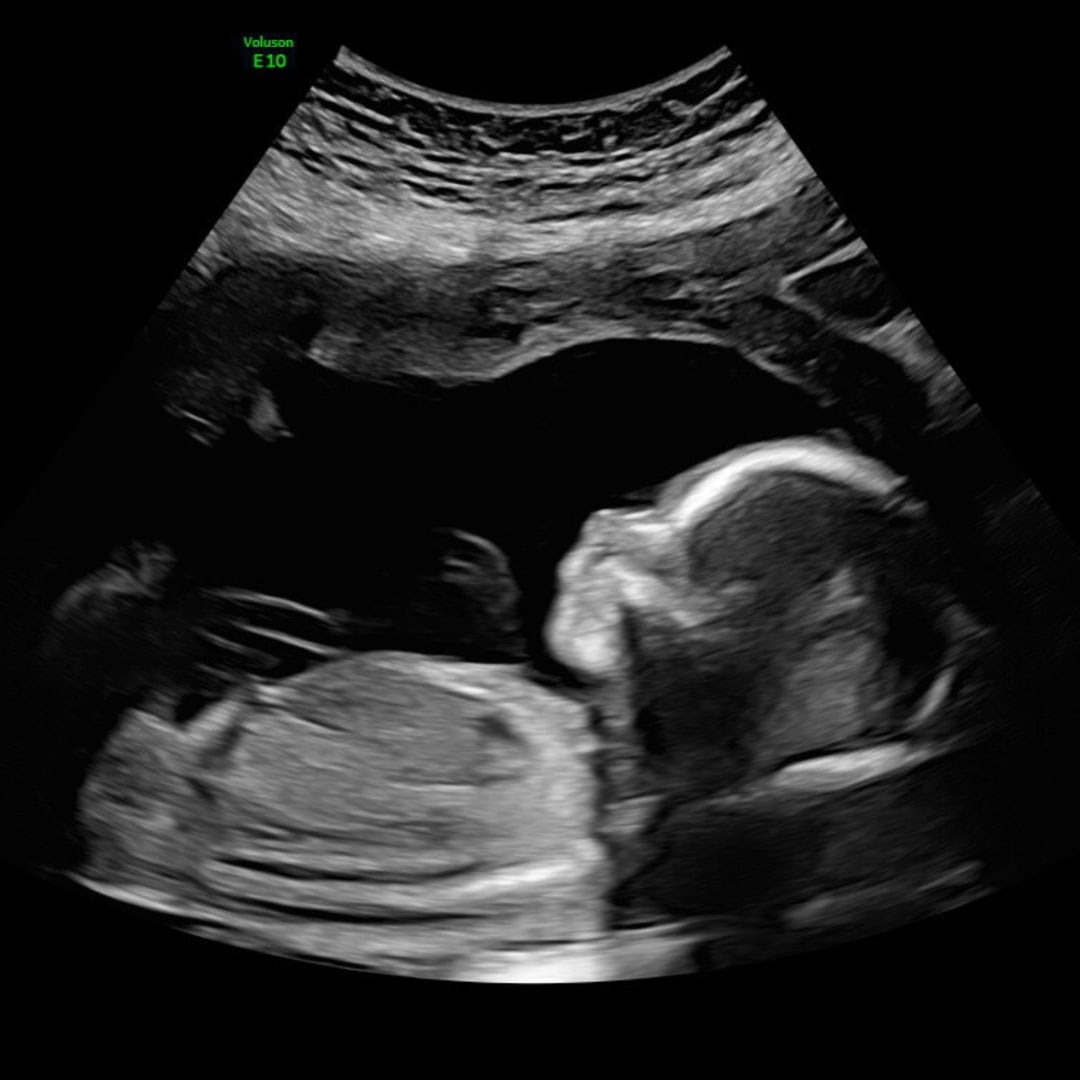 Photo shared by Jennifer for their Babylist baby registry.